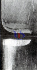 cemented carbide tool wear